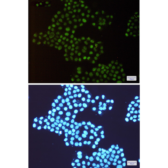 TRMT2A Antibody in Immunocytochemistry (ICC/IF)