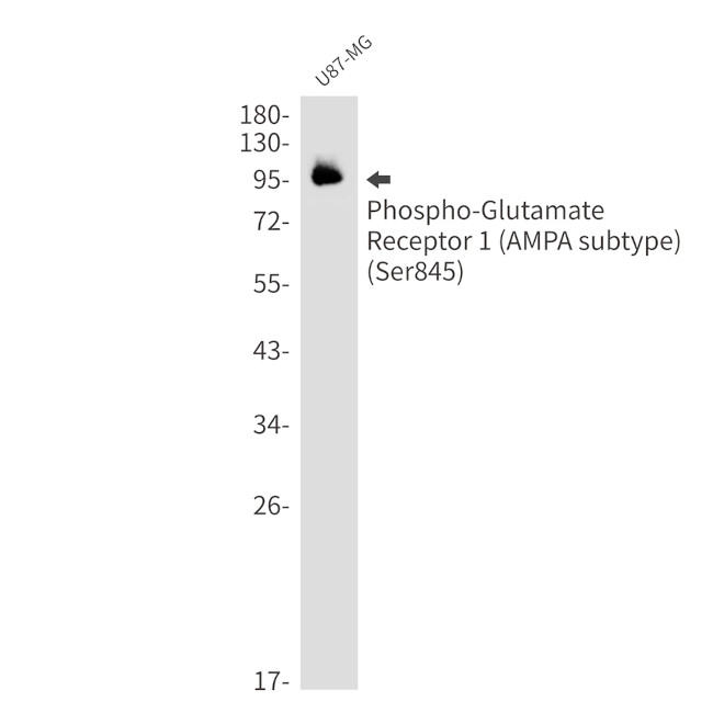 Phospho-GluR1 (Ser845) Antibody in Western Blot (WB)