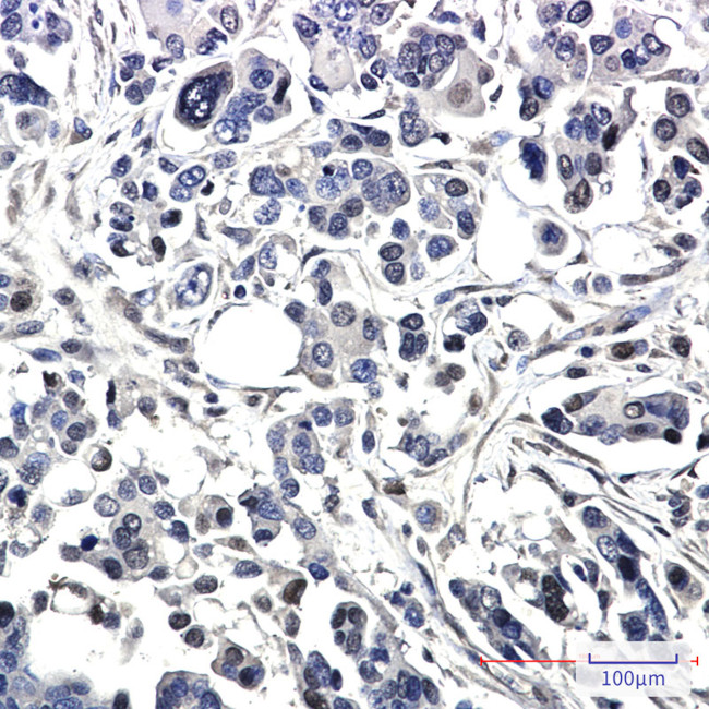 BAG1 Antibody in Immunohistochemistry (Paraffin) (IHC (P))