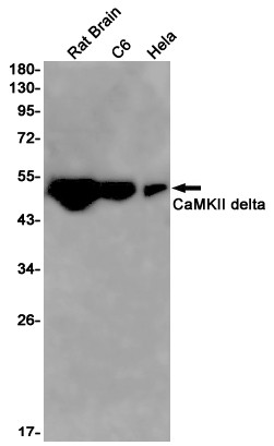 CaMKII delta Antibody in Western Blot (WB)