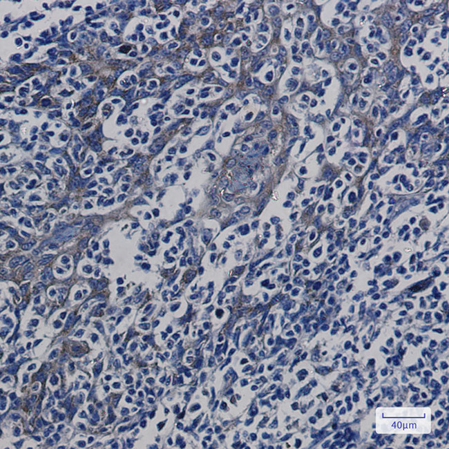 ATP5G1/ATP5G2/ATP5G3 Antibody in Immunohistochemistry (Paraffin) (IHC (P))