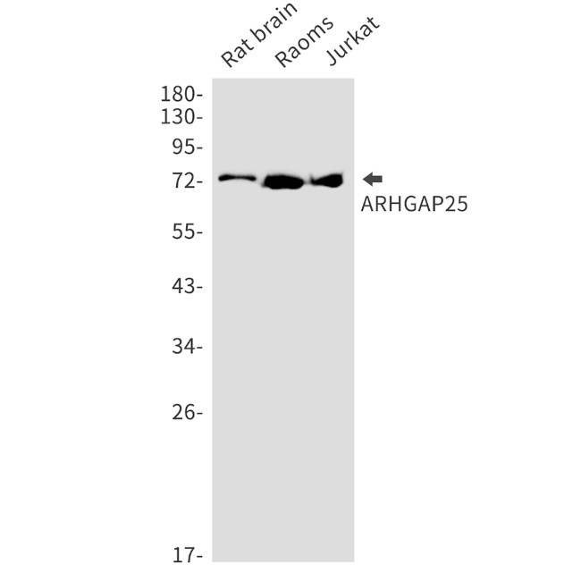 ARHGAP25 Antibody in Western Blot (WB)