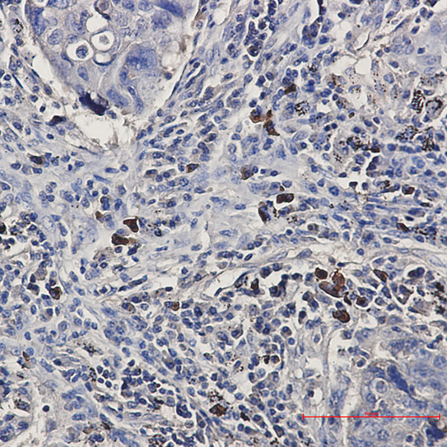 BNIP3L Antibody in Immunohistochemistry (Paraffin) (IHC (P))