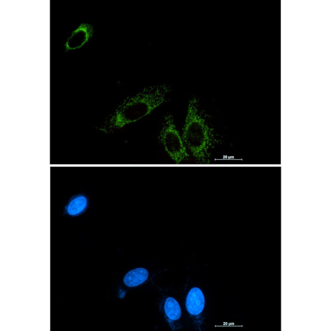 P2Y6 Antibody in Immunocytochemistry (ICC/IF)