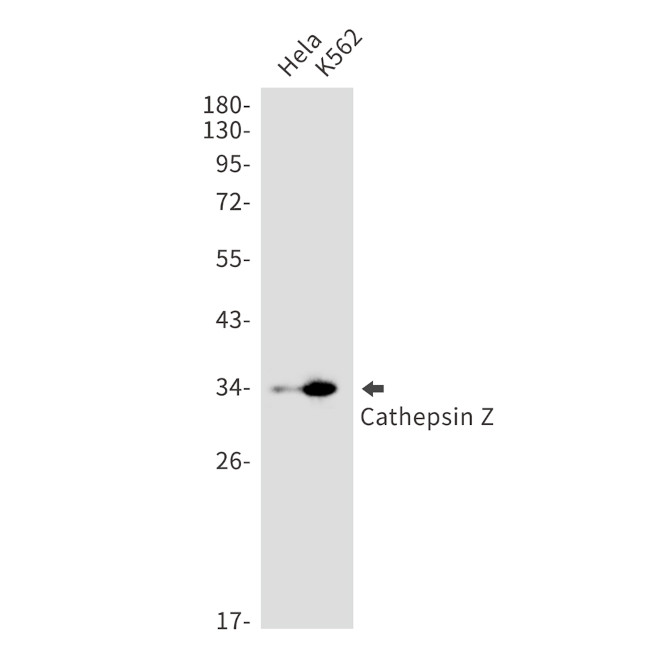 Cathepsin Z Antibody in Western Blot (WB)