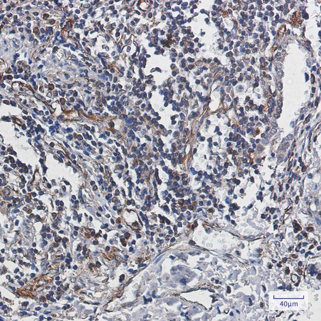 Caspase 10 Antibody in Immunohistochemistry (Paraffin) (IHC (P))