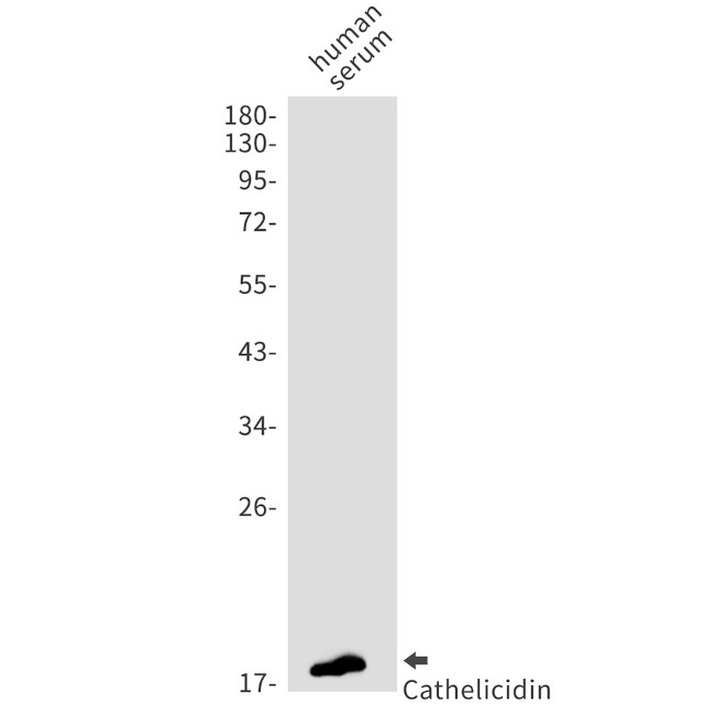 Cathelicidin Antibody in Western Blot (WB)