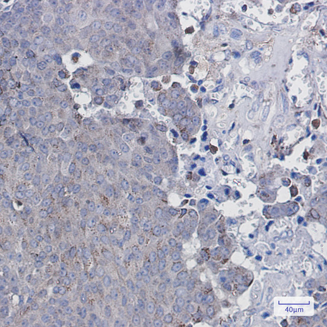 ATGL Antibody in Immunohistochemistry (Paraffin) (IHC (P))