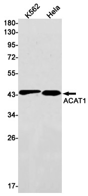 ACAT1 Antibody in Western Blot (WB)