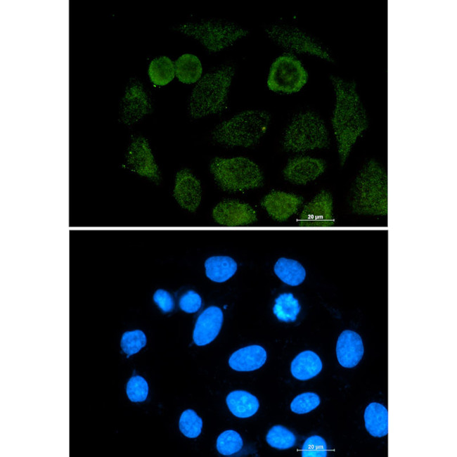 ATF2 Antibody in Immunocytochemistry (ICC/IF)