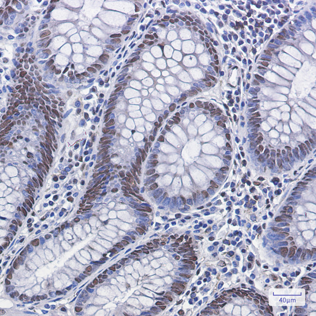 Phospho-MDM2 (Ser166) Antibody in Immunohistochemistry (Paraffin) (IHC (P))