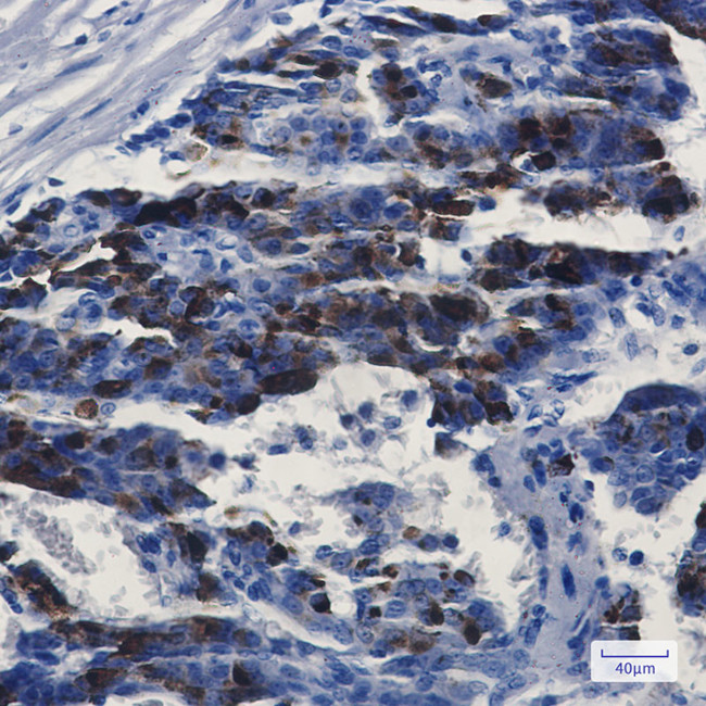 MMP14 Antibody in Immunohistochemistry (Paraffin) (IHC (P))
