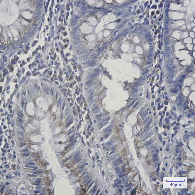 AGPS Antibody in Immunohistochemistry (Paraffin) (IHC (P))
