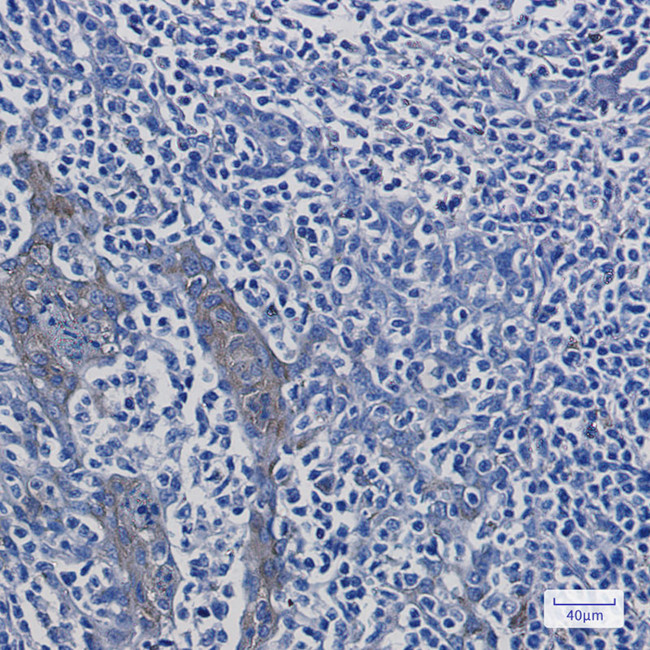 ATP6V1A Antibody in Immunohistochemistry (Paraffin) (IHC (P))