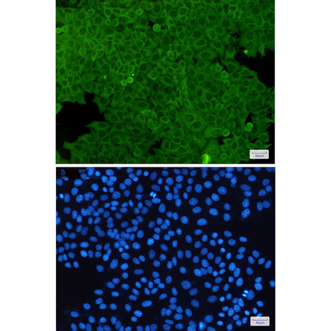 Annexin A2 Antibody in Immunocytochemistry (ICC/IF)