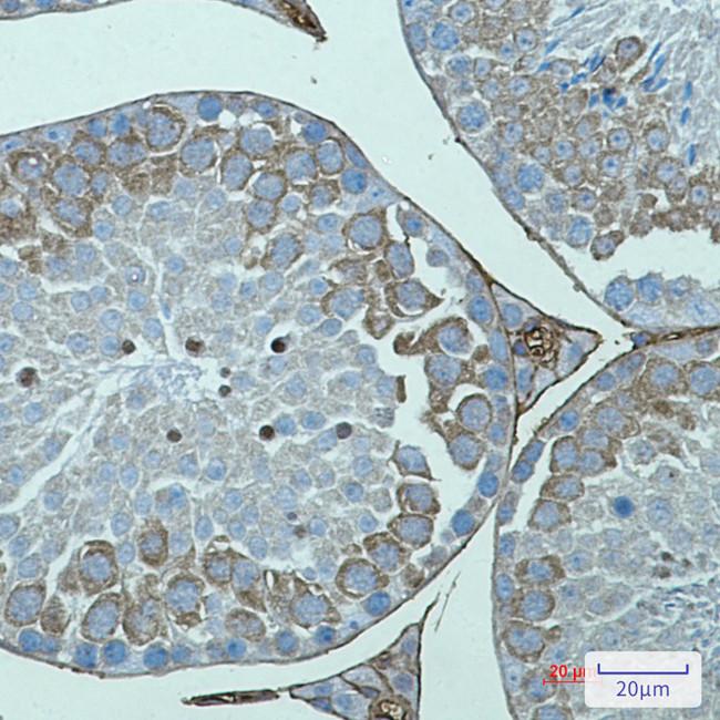 AVEN Antibody in Immunohistochemistry (Paraffin) (IHC (P))