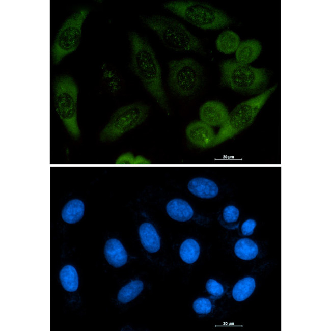 Profilin 1 Antibody in Immunocytochemistry (ICC/IF)