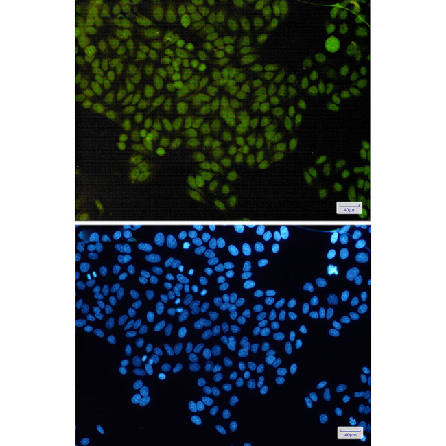 APE1 Antibody in Immunocytochemistry (ICC/IF)