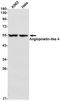 ANGPTL4 Antibody in Western Blot (WB)