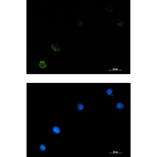 c-Cbl Antibody in Immunocytochemistry (ICC/IF)
