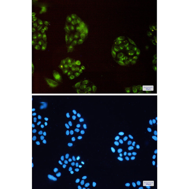 ATP6V0D1 Antibody in Immunocytochemistry (ICC/IF)
