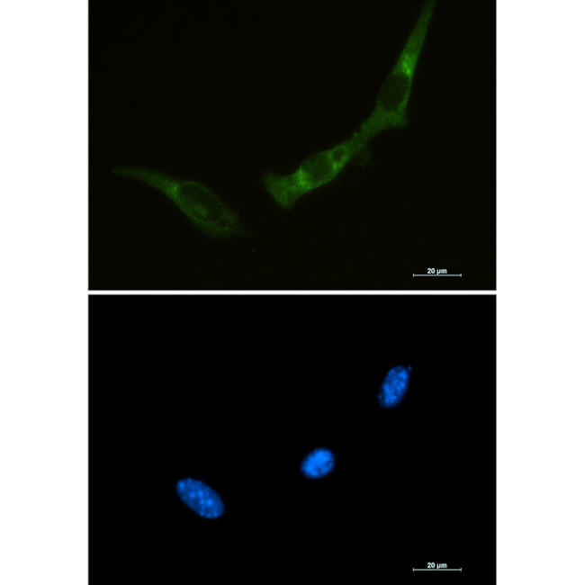 PKR Antibody in Immunocytochemistry (ICC/IF)