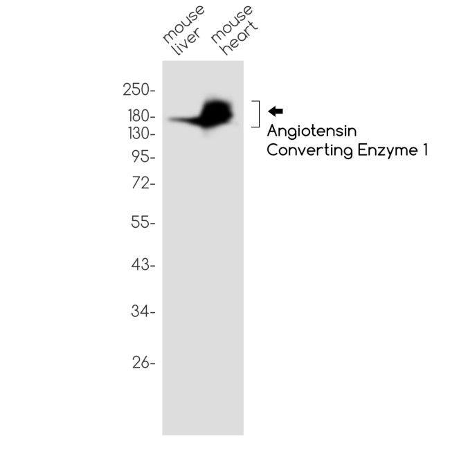 ACE Antibody in Western Blot (WB)