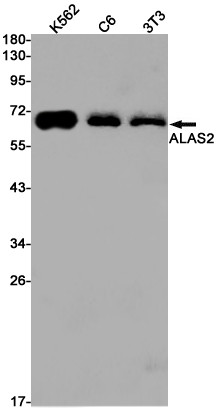 ALAS2 Antibody in Western Blot (WB)