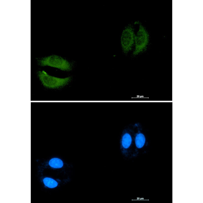 RAB5C Antibody in Immunocytochemistry (ICC/IF)