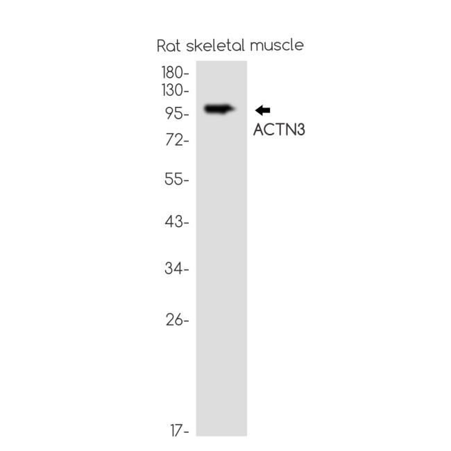 alpha Actinin 3 Antibody in Western Blot (WB)