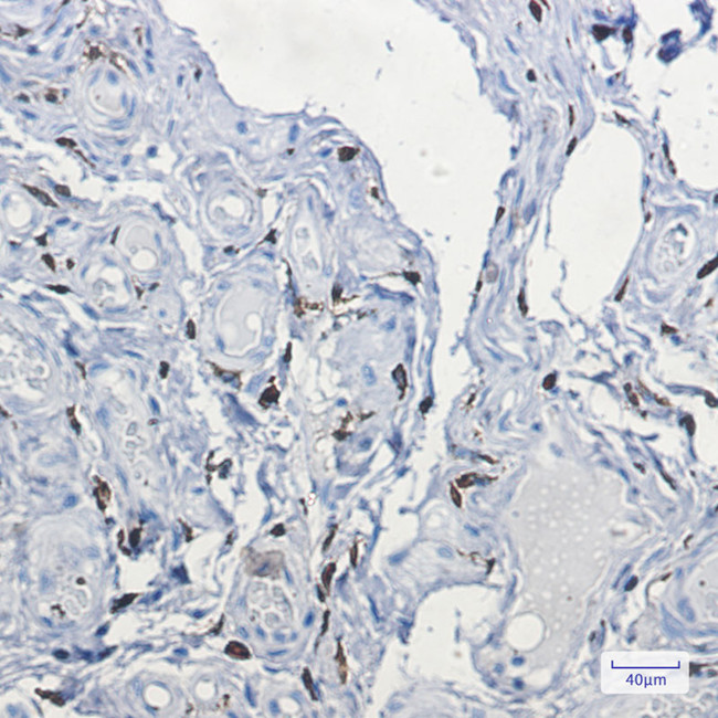 Factor XIII Antibody in Immunohistochemistry (Paraffin) (IHC (P))