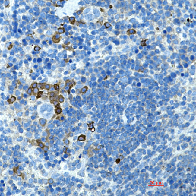 BTLA Antibody in Immunohistochemistry (Paraffin) (IHC (P))