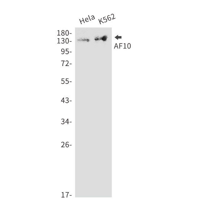 MLLT10 Antibody in Western Blot (WB)