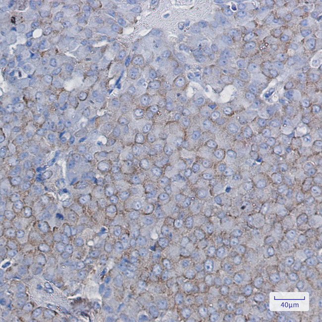 BTF3 Antibody in Immunohistochemistry (Paraffin) (IHC (P))
