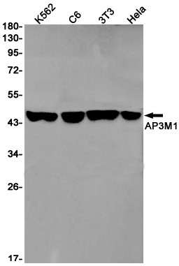 AP3M1 Antibody in Western Blot (WB)