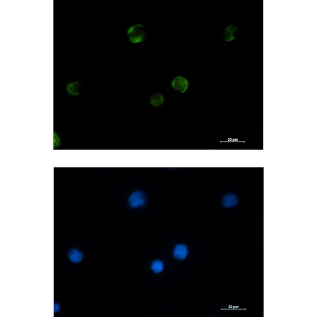 PAK1 Antibody in Immunocytochemistry (ICC/IF)