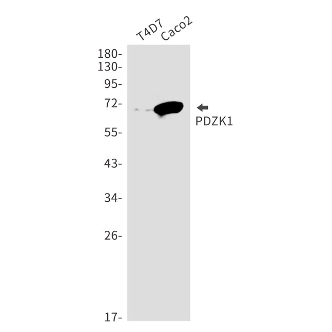 PDZK1 Antibody in Western Blot (WB)
