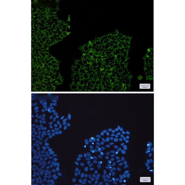 HADHA Antibody in Immunocytochemistry (ICC/IF)