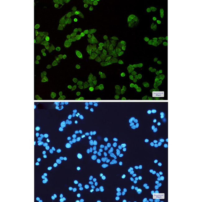 STAT5 alpha Antibody in Immunocytochemistry (ICC/IF)