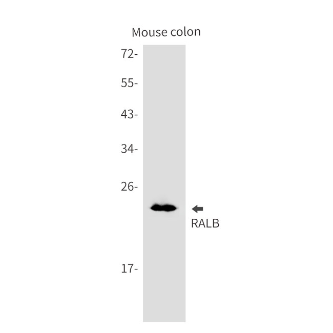 RALB Antibody in Western Blot (WB)