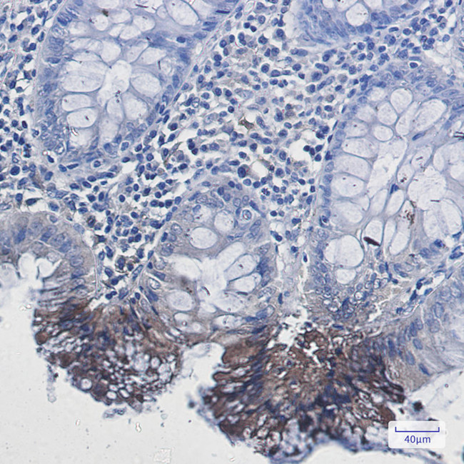RAB9 Antibody in Immunohistochemistry (Paraffin) (IHC (P))