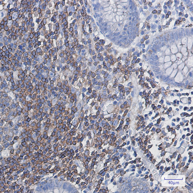 PHD3 Antibody in Immunohistochemistry (Paraffin) (IHC (P))