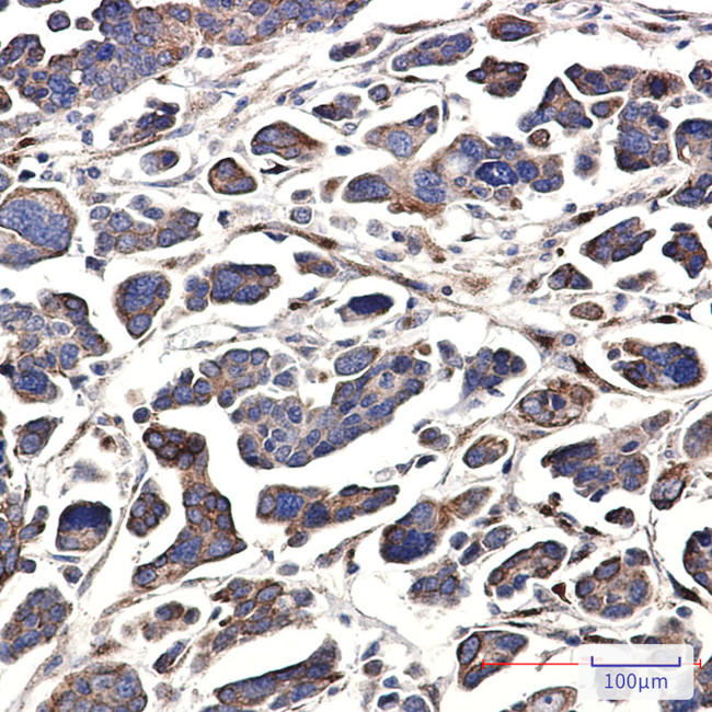 GNA13 Antibody in Immunohistochemistry (Paraffin) (IHC (P))