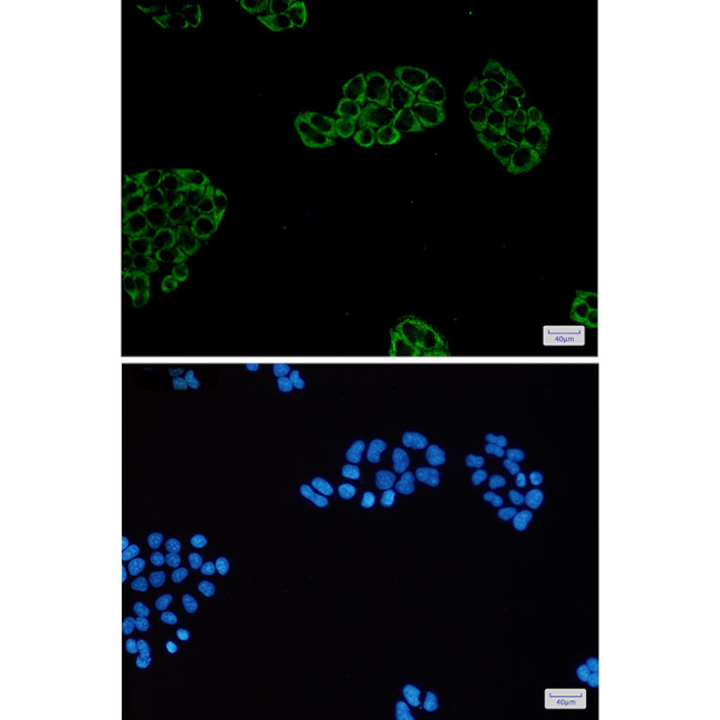PGM1 Antibody in Immunocytochemistry (ICC/IF)