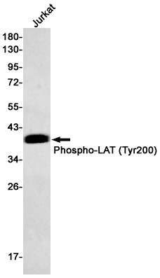 Phospho-LAT (Tyr200) Antibody in Western Blot (WB)