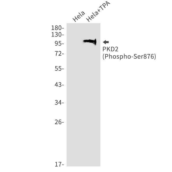 Phospho-PRKD2 (Ser876) Antibody in Western Blot (WB)
