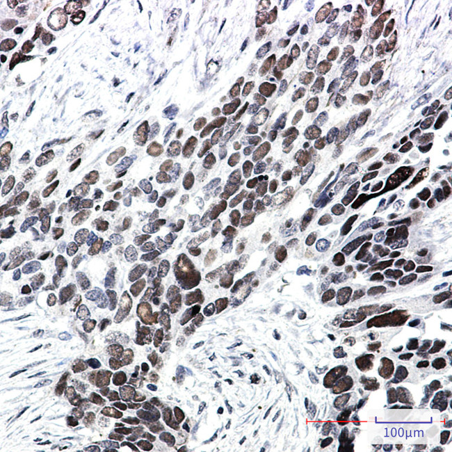 TCF7L2 Antibody in Immunohistochemistry (Paraffin) (IHC (P))