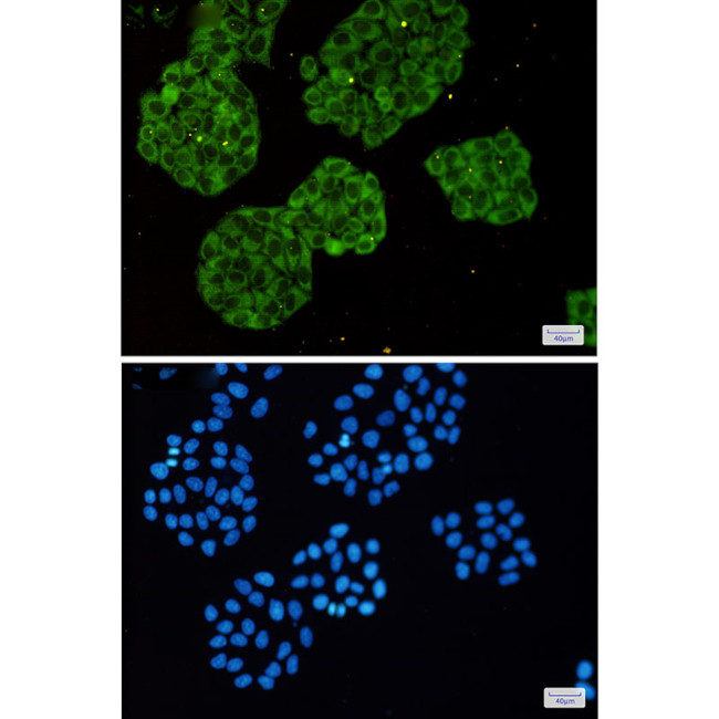 MARS Antibody in Immunocytochemistry (ICC/IF)