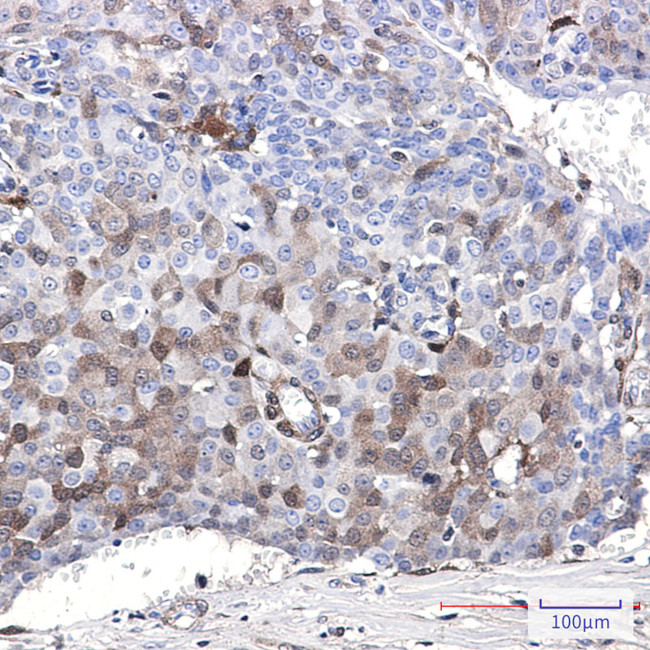 CDKN2C Antibody in Immunohistochemistry (Paraffin) (IHC (P))