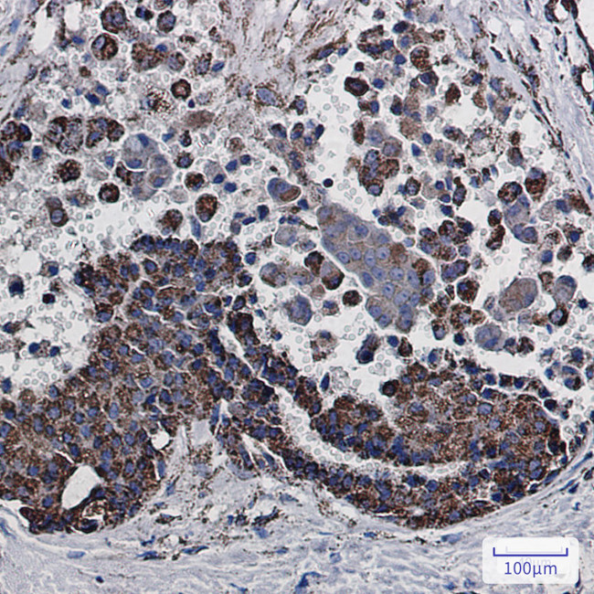 MDH2 Antibody in Immunohistochemistry (Paraffin) (IHC (P))